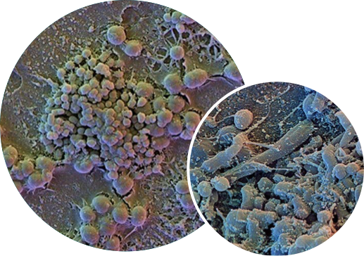 Side by side 2 graphic images of Plaque biofilm