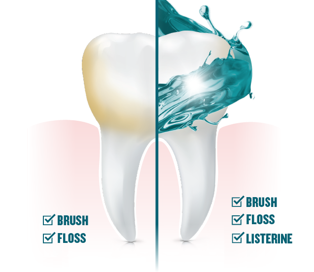 A graphic image of a tooth showing listerine mouthwash is being used on one half along with brushing and flosing.